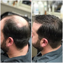 Super Oferta Biotim + Shampoo Escurecimento Capilar