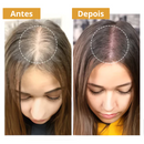Biotim Serum Anti-Queda e Crescimento Capilar |COMPRE 2 LEVE 3| + Frete Grátis