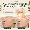 VerruZen Creme [COMPRE 1 LEVE 2] + Frete Grátis