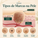 VerruZen Creme [COMPRE 1 LEVE 2] + Frete Grátis