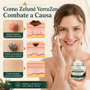 VerruZen Creme [COMPRE 1 LEVE 2] + Frete Grátis