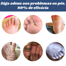 Furzero™ Spray Anti Fungos Chulé Frieira |COMPRE 1 LEVE 2| + Frete Grátis